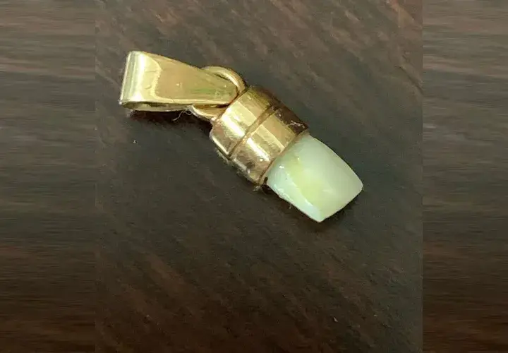 Mayweather Tooth
