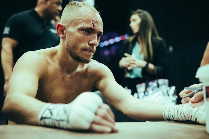 In-depth with Sunny Edwards: ‘The scar is a great addition to my face’