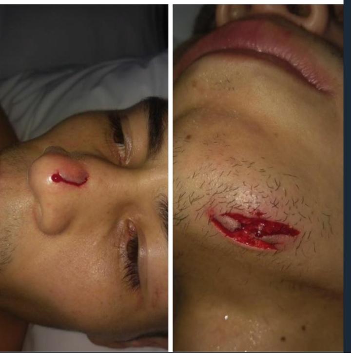 Andres Gutierrez Injuries