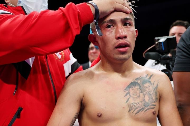 Chocolatito Martinez Fight