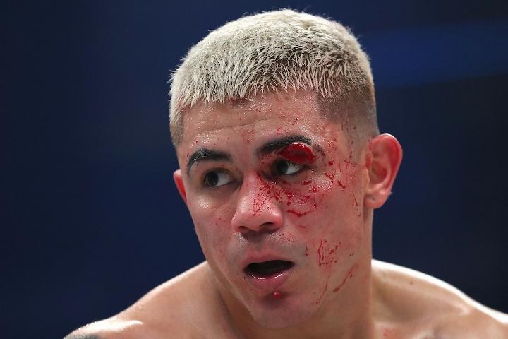 Diaz Farmer Fight