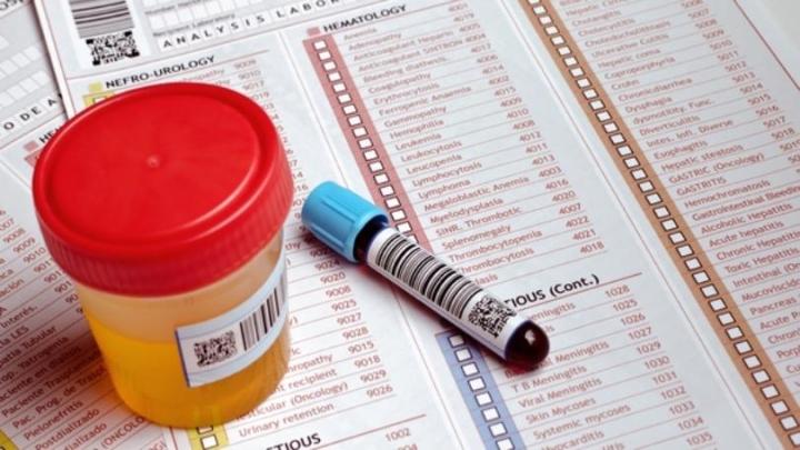 Drug Testing