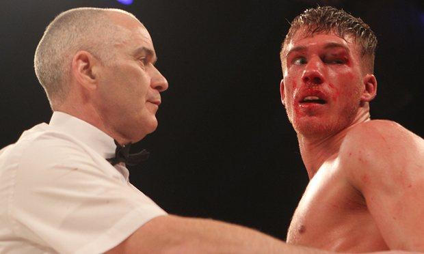Nick Blackwell