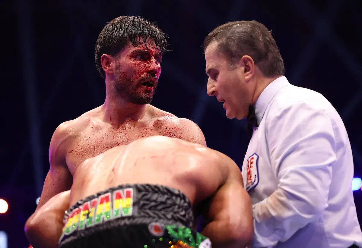 Bloody Josh Kelly fends off Caoimhin Agyarko
