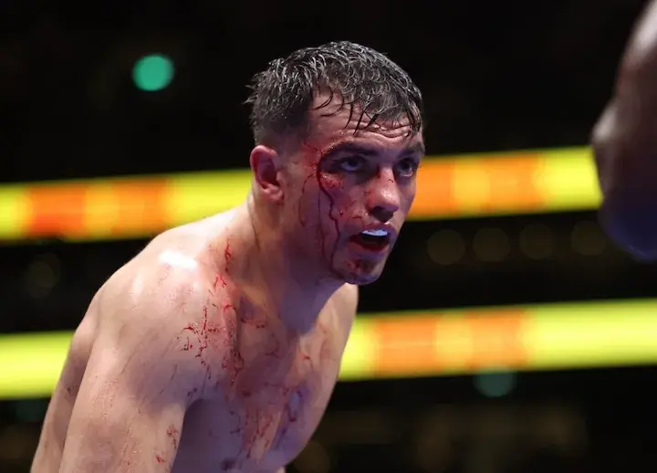 A bloodied Jack Catterall looks intently at opponent Ekow Essuman (mostly out of frame) en route to his stoppage victory on November 15, 2025.