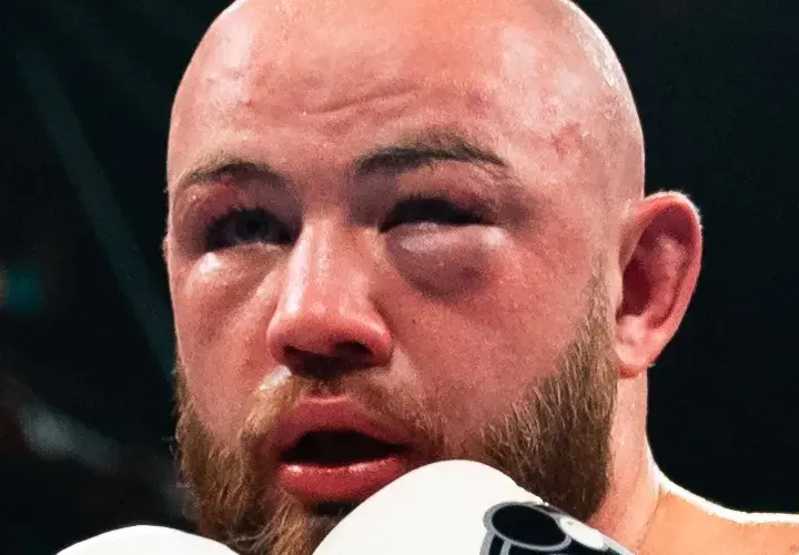 Adam Kownacki