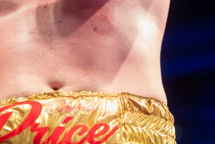 David Price Ali Fight