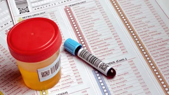 Drug Testing