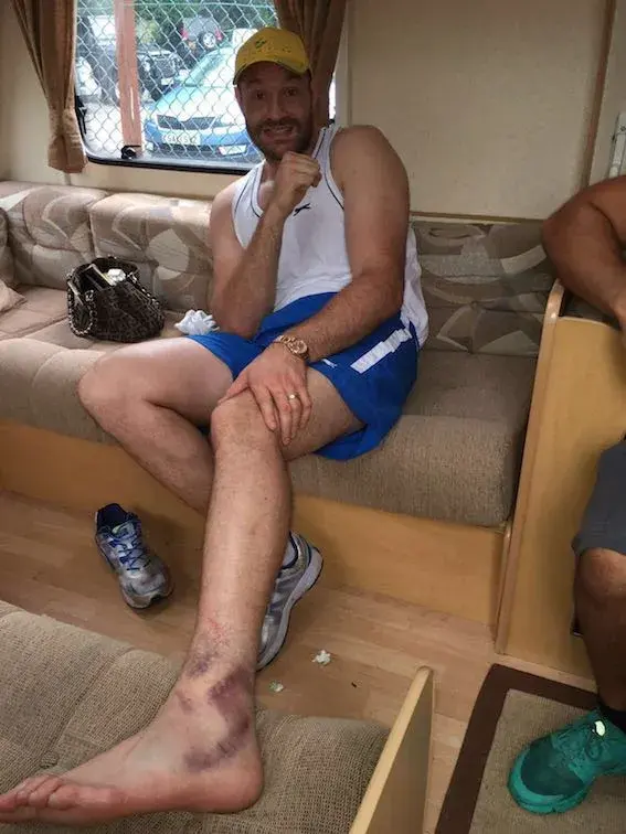 Fury Ankle