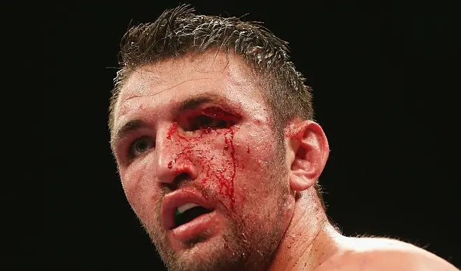 Hughie Fury Cut Kassi