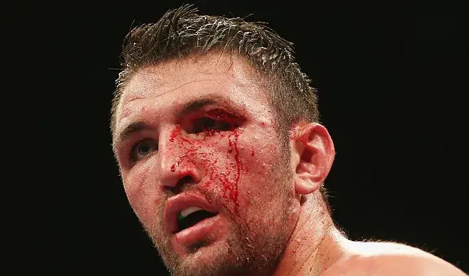 Hughie Fury Cut Kassi