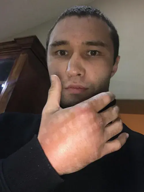 Lipinets Hand