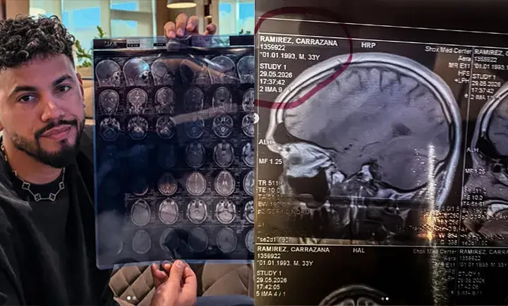 Robeisy Ramirez poses with what appears to be the results of an MRI scan on May 29, 2026